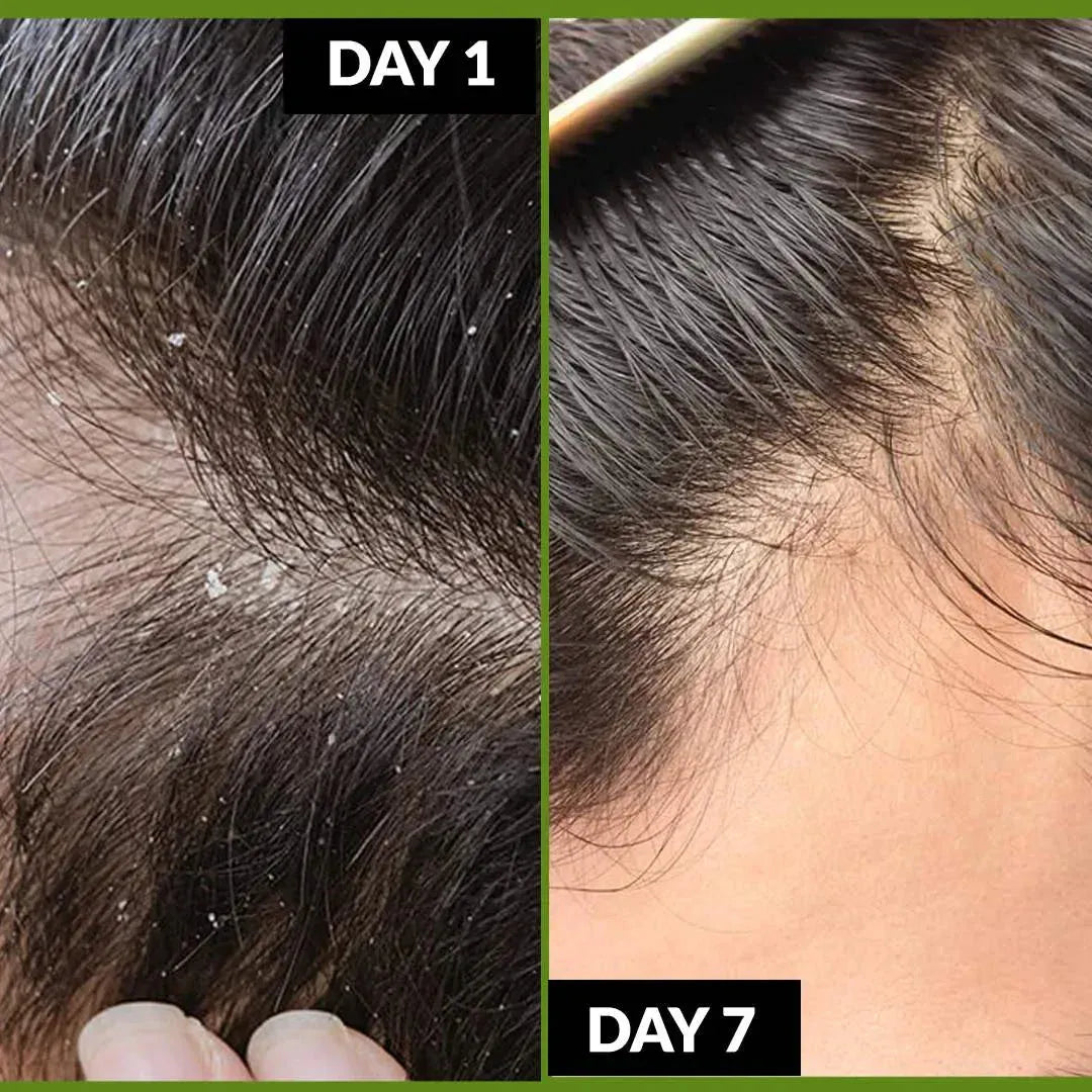 Hair care Oil 100% Organic 200 ML BIG SIZE